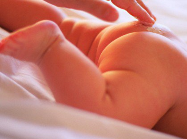 Cegah Ruam Popok Pada Bayi Bayi Dengan Produk Lotion